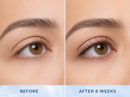 Non-Prostaglandin Lash Serum | BOGO FREE